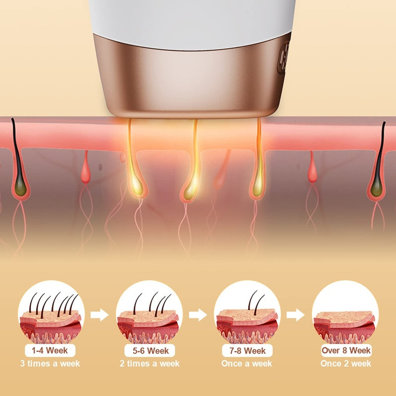 Home laser hair removal device
